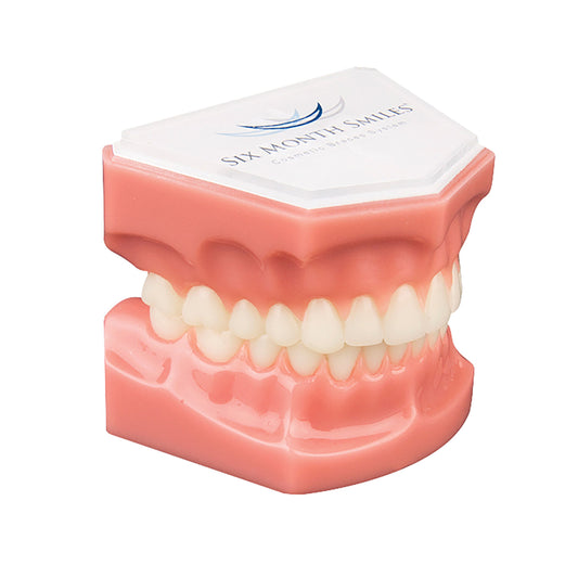Consultation Model (No Brackets)