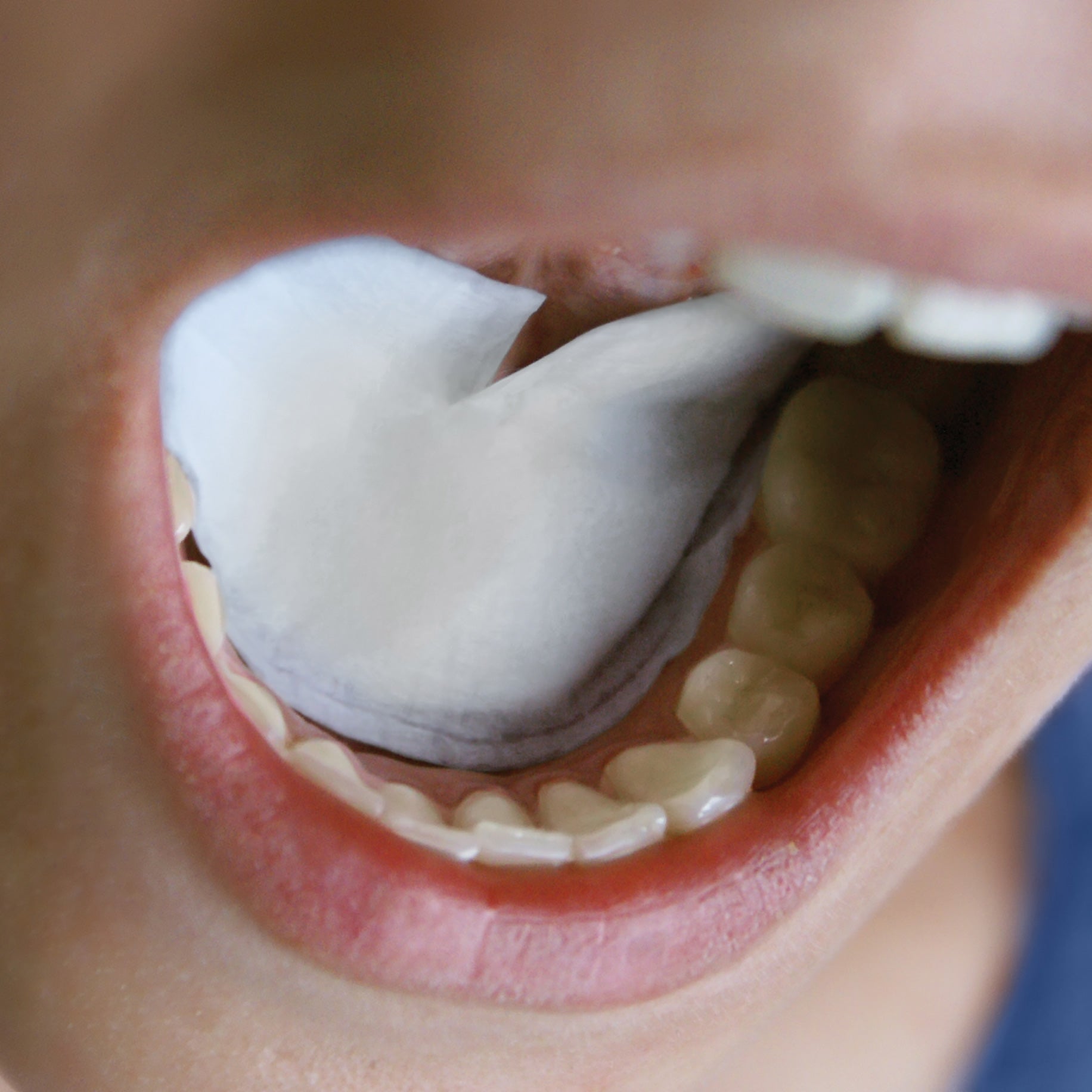 DryDent Sublingual Saliva Control Small