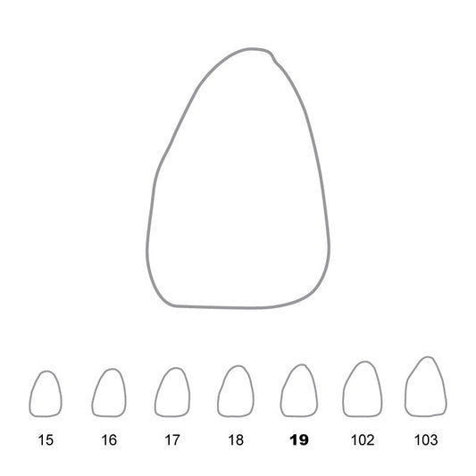 Temporary Crowns Upper Central Incisors Left 19