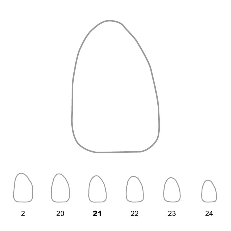Temporary Crowns Upper Lateral Incisors Right 21