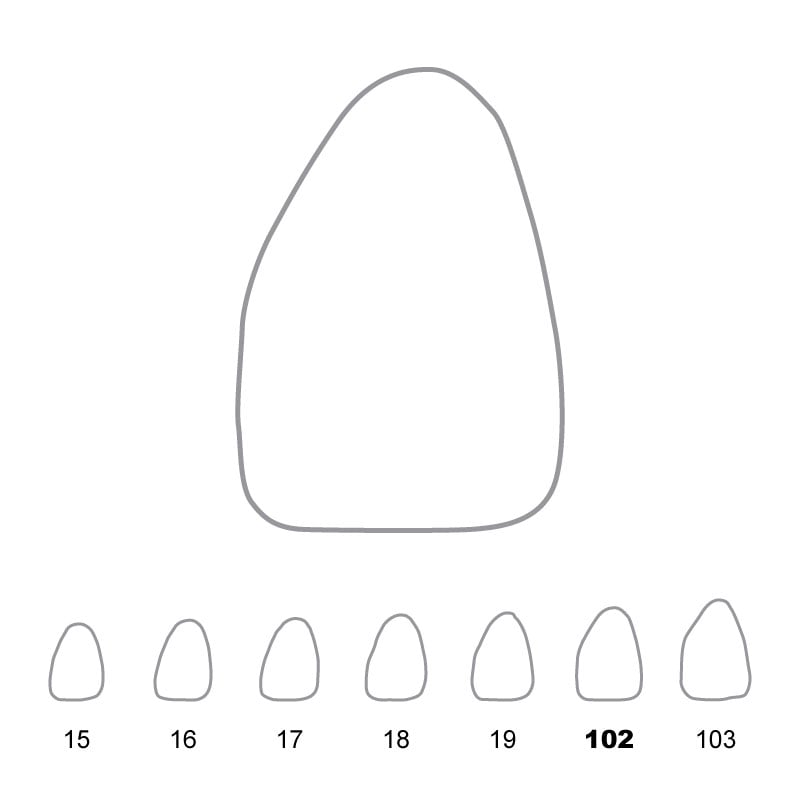 Temporary Crowns Upper Central Incisors Left 102